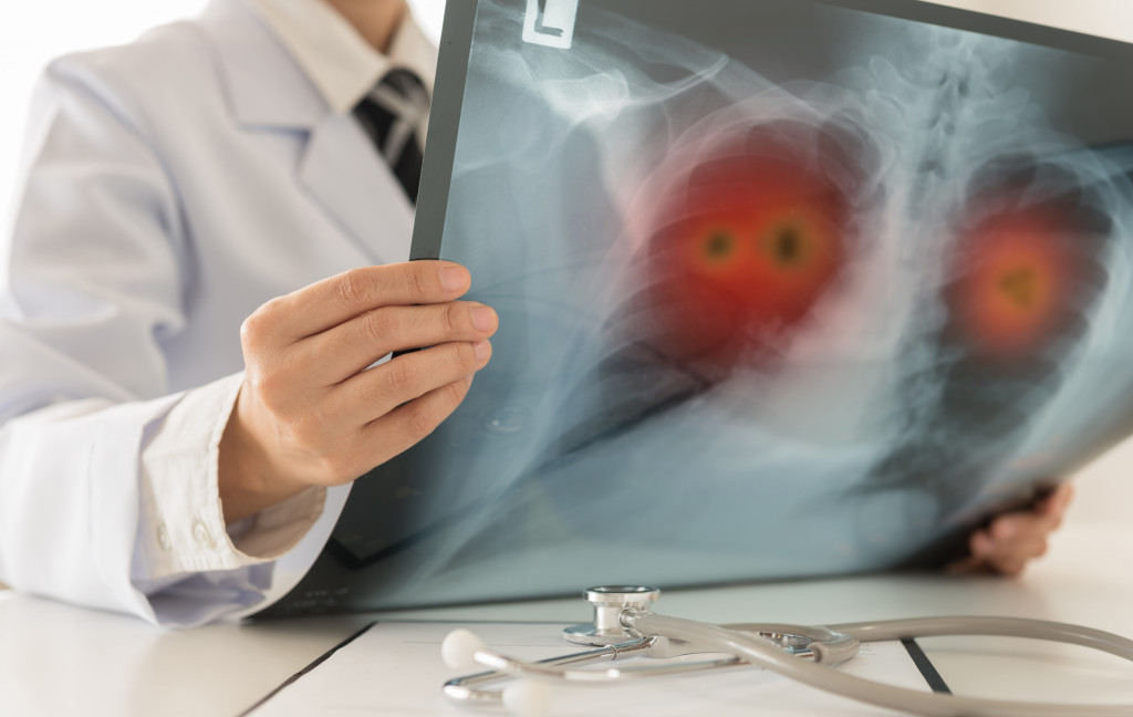 Virus in lungs seen through x-ray